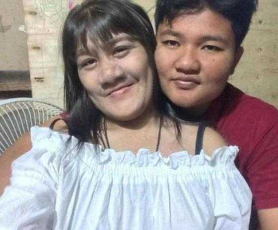 Dünyanın ən tüklü qızını bir də indi görün -  FOTOLAR